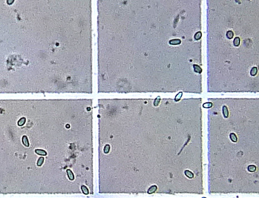 YesYesNosema - CV Fungal Spore Counter